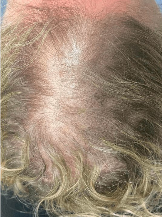 Before Image