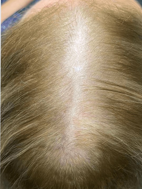 After Image
