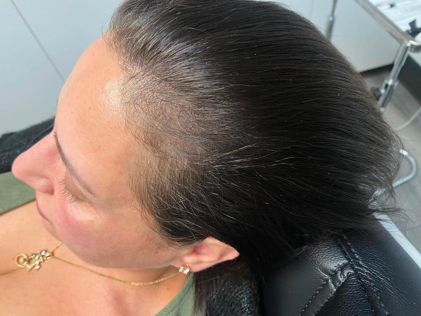 Before Image